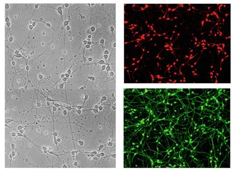 Primary Cultured Neurons Creative Bioarray