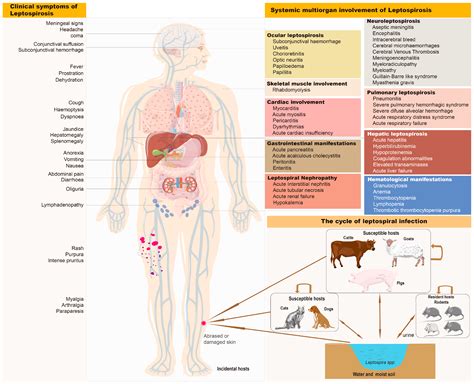 Weil’s Disease in an HIV-Infected Patient: A Case Report and Literature