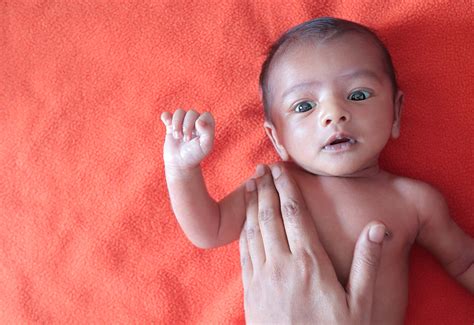 Cerebral Palsy Pada Anak Gejala Penyebab Dan Penanganan Rs Pondok