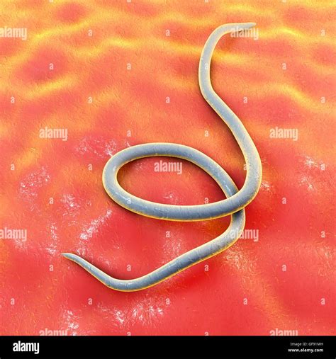 Threadworms