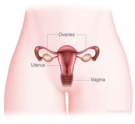 Uterine Fibroid Embolization South Jersey - Lourdes Imaging Associates
