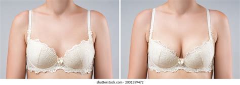 Hundred Before After Naked Woman Royalty Free Images Stock Photos Pictures Shutterstock