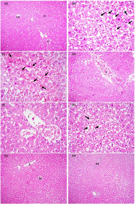 Photomicrograph Of Rat Liver Section Stained With Haematoxyline And