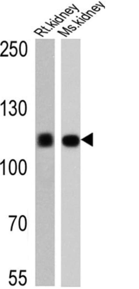 Atp1a1 Monoclonal Antibody M8 P1 A3 Invitrogen™ 100 μg Unconjugated