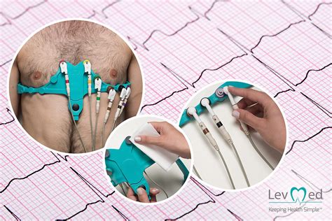 Levmed Questions And Answers