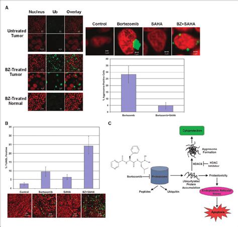 Bortezomib Induces Aggresome Formation In An Orthotopic Pancreatic Download Scientific Diagram