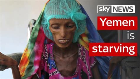 United Nations Appeal To Avert Famine In War Ravaged Yemen