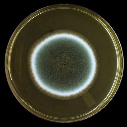 Fun With Microbiology What S Buggin You Aspergillus Fumigatus