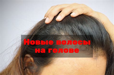 Новые волосы на голове как отрастить в домашних условиях