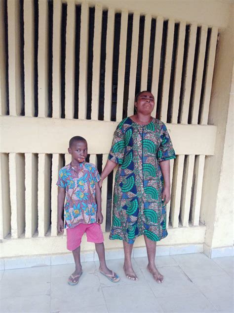 Woman C Uts Off Her Step Grandson S Lips With Hot Knife In Taraba