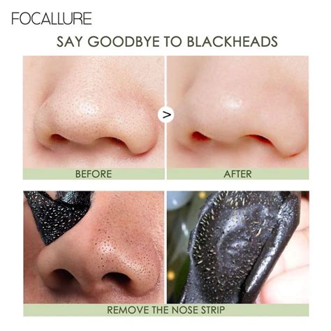 Blackhead Remover Pore Strips