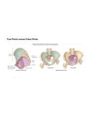 understanding true pelvis  false pelvis key differences  hero