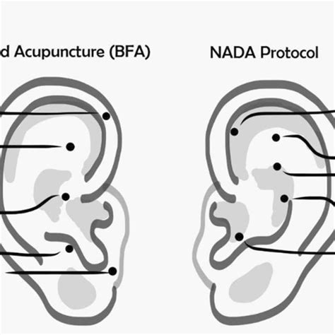 Homunculus Mapped Onto The External Ear Download Scientific Diagram