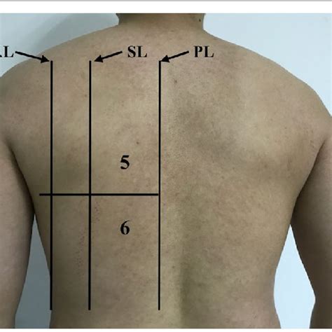 Pleural Line Abnormalities Irregular Thickened Fragmented Pleural Line
