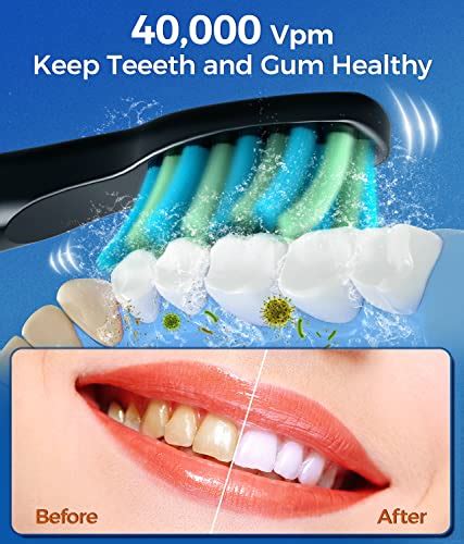 Fairywill Electric Toothbrush Review: (Is It Worth It In 2024?) - Mouth ...