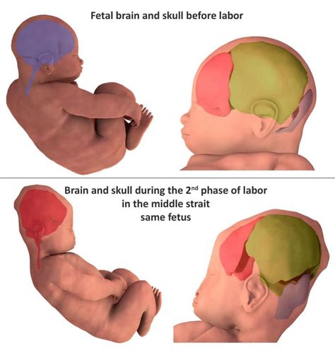 3d Images Reveal How Much Infants Heads Deform During Birth Clinical