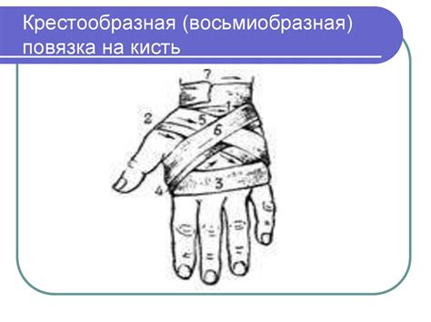 Виды повязок. Правила наложения повязок на голову, нижние и верхние ...
