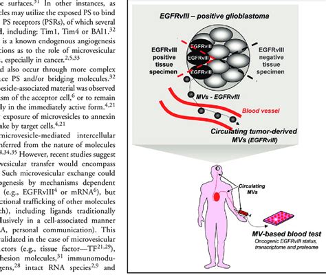 Microvesicles MVs As A Putative Biomarker In Human Glioma Detection