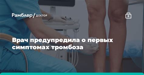 Врач предупредила о первых симптомах тромбоза - Рамблер/доктор