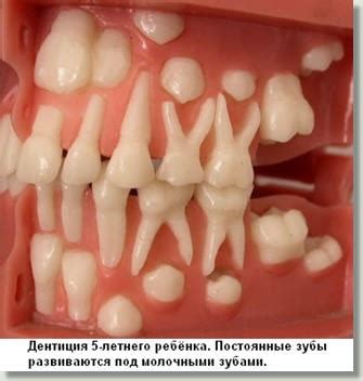 Познавательно, про детские зубы. — 34 ответов | форум Babyblog