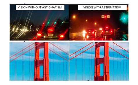 Astigmatism Vision