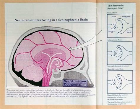 Schizophrenia Ability Magazine