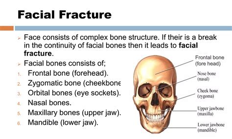 Cranial And Facial Fractures Pptx