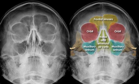 Pin By Haley Copeland On Quick Saves Radiography Medical Radiography