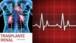 Protocolo Trasplante Renal PPT