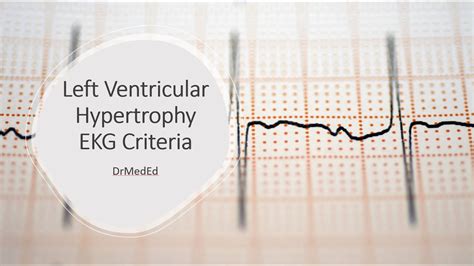 Left Ventricular Hypertrophy Ekg Criteria Sokolow Lyon And Cornell