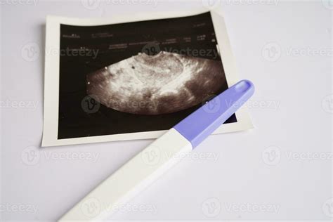 Pregnancy Test With Ultrasound Scan Photo Of Fetus Maternity
