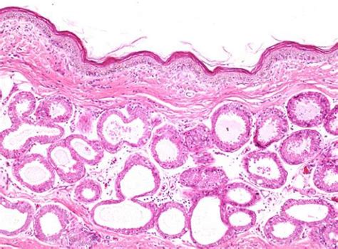 Glands Of The Canine Anal Sac Higher Magnification Collection Of