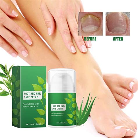 Deep Nourishing Foot Nail Care Nurturing Nail Health For Smooth And