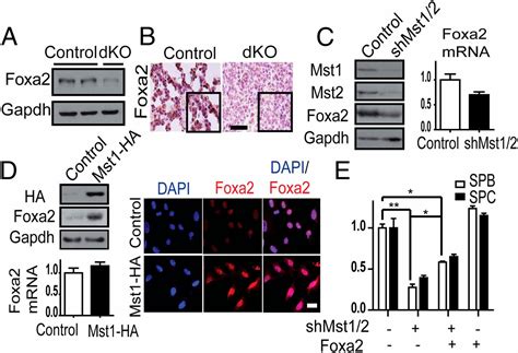 Hippo Foxa2 Signaling Pathway Plays A Role In Peripheral Lung