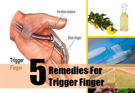 5 Remedies For Trigger Finger The Bodys Structure Pinterest