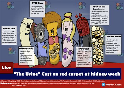 Kidney Comics The Urine Casts Renal Fellow Network