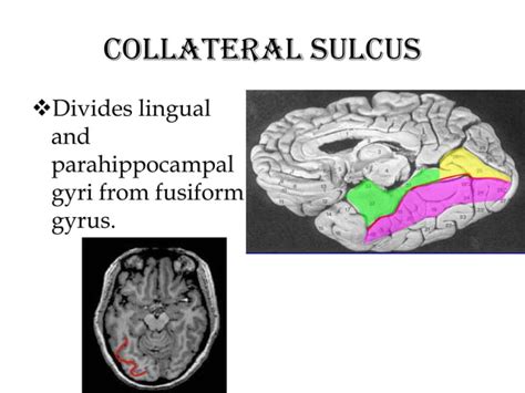 Anatomy of brain sulcus and gyrus - Dr.Sajith MD RD