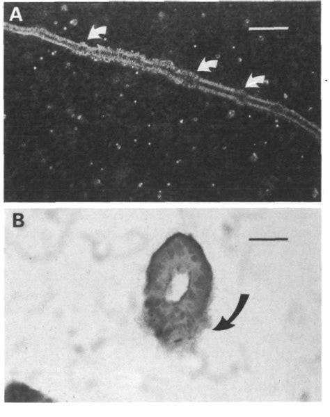 Figure From A Nude Mouse Xenograft Model Of Fetal Intestine