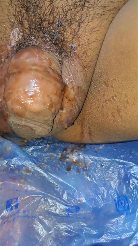 Myanmar Gay Homemade Sm Hot Wax Solo Collection BoyFriendTV