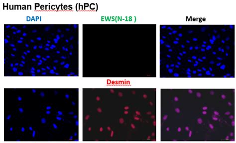 Hypoxia induces lineage modulation of Ewing?s sarcoma tumor cells into ...