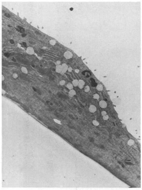 Transmission Electron Micro Graph Of Human Mesothelial Cells Stained