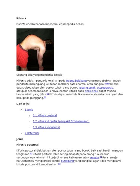 Kelainan Pada Tulang Kifosis Pdf