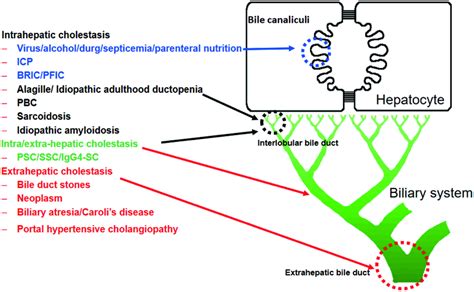 Location Of Injuries That Lead To Cholestatic Liver Disease Bric