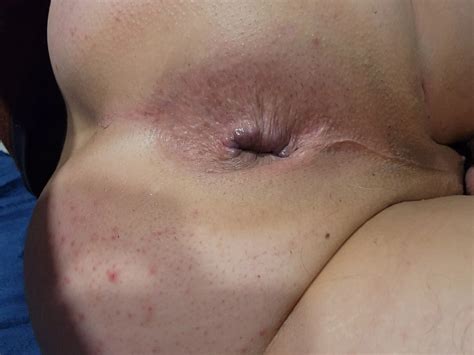 My Gaping Hole Nude Pics XHamster