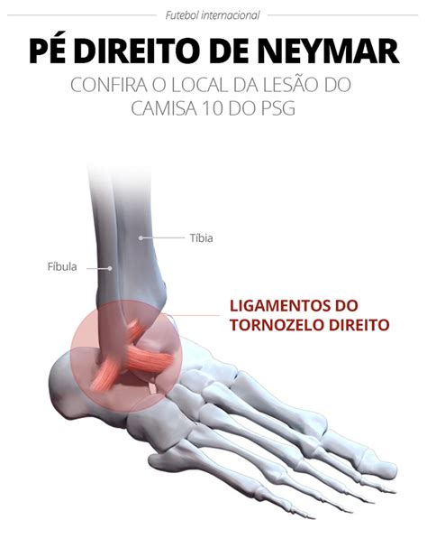 Neymar Tem Les O Ligamentar No Tornozelo Informa Psg Feito Ms