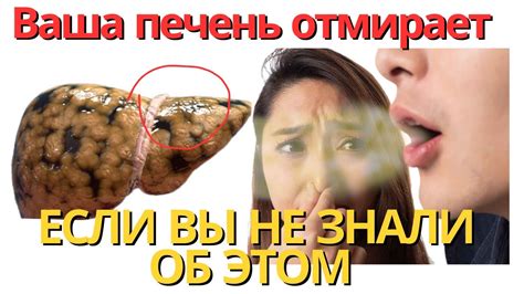 14 признаков что вашу печень нужно спасать. Люди даже не знают об этом ...