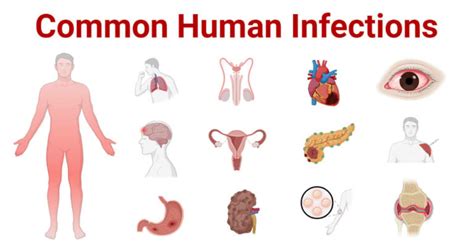 Common Human Infections And Causative Agents