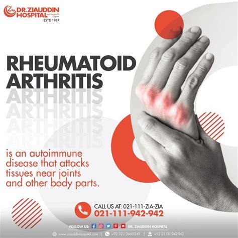 Rheumatoid Arthritis Dr Ziauddin Hospital Artofit