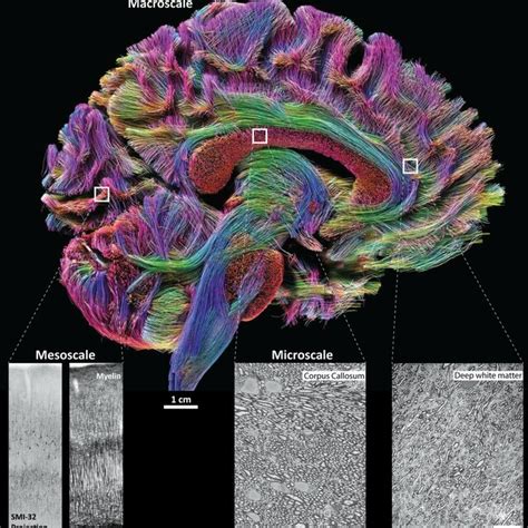 Integrating human brain connectivity at the macro, meso and micro ...
