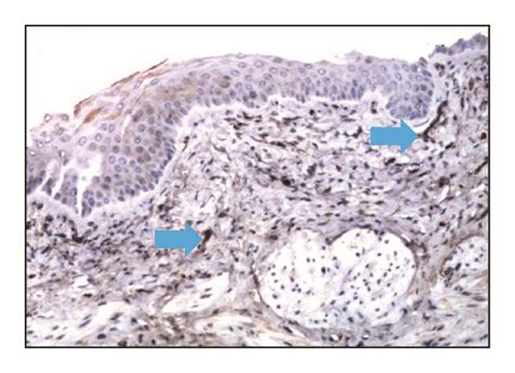 Immunohistochemical Photomicrographs Of Sections Taken From Vaginal Download Scientific Diagram